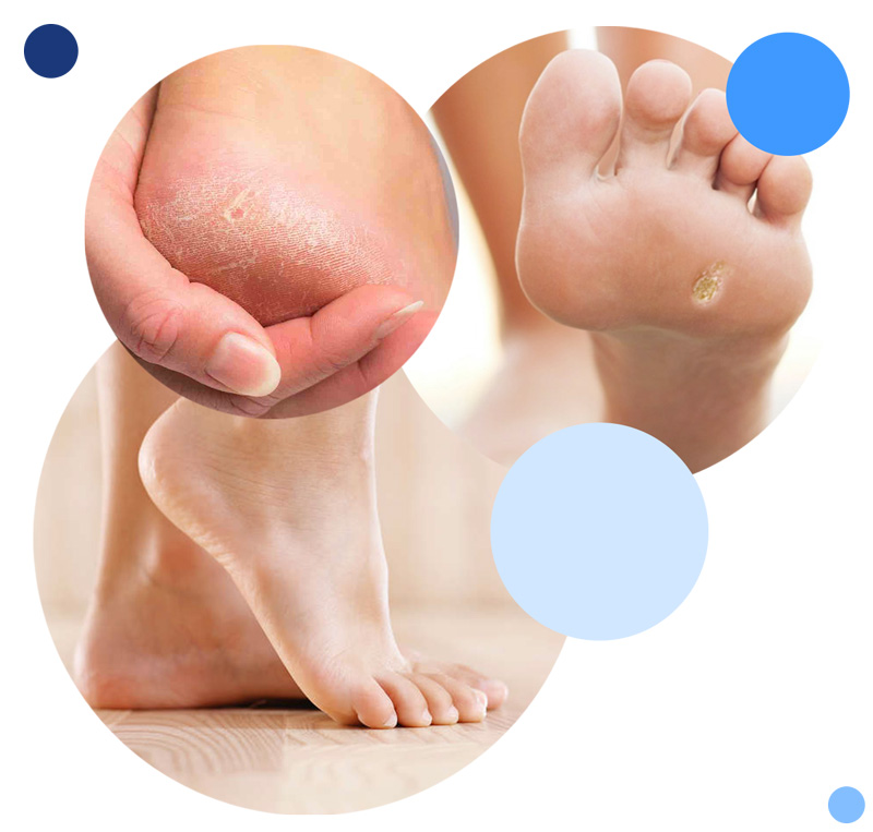 RescueDerm